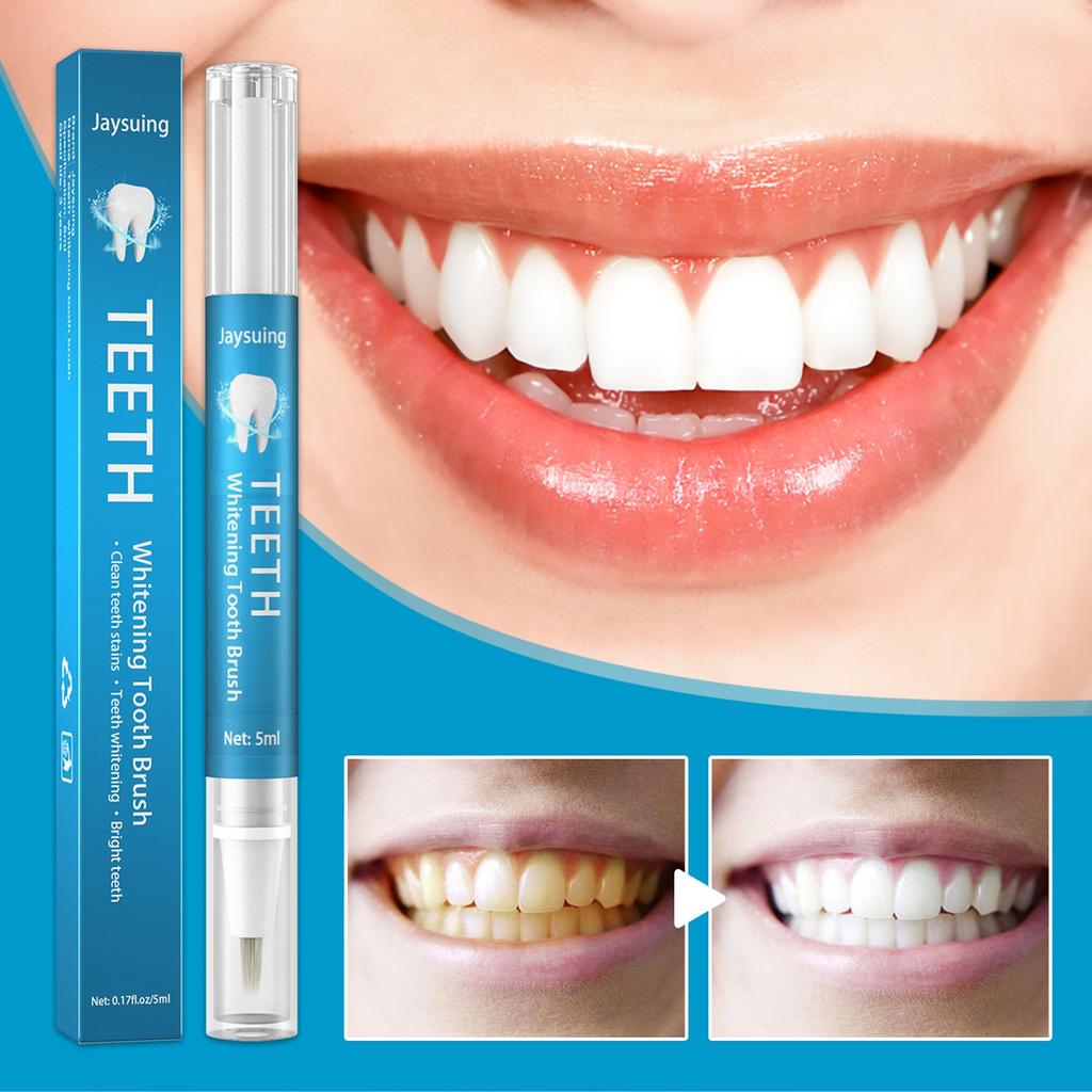 Zahnaufhellungswerkzeug, Peroxidgel, Zahnreinigung, Bleichset, Aufhellungsstift, Flecken entfernen, 5 ml