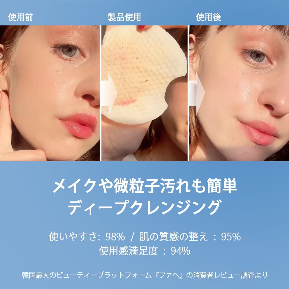 NIGHTINGALE DAILY DERMA CLEANSING PADS MILD ACID (Mild Acid) - Makeup Remover Sheets for Sensitive