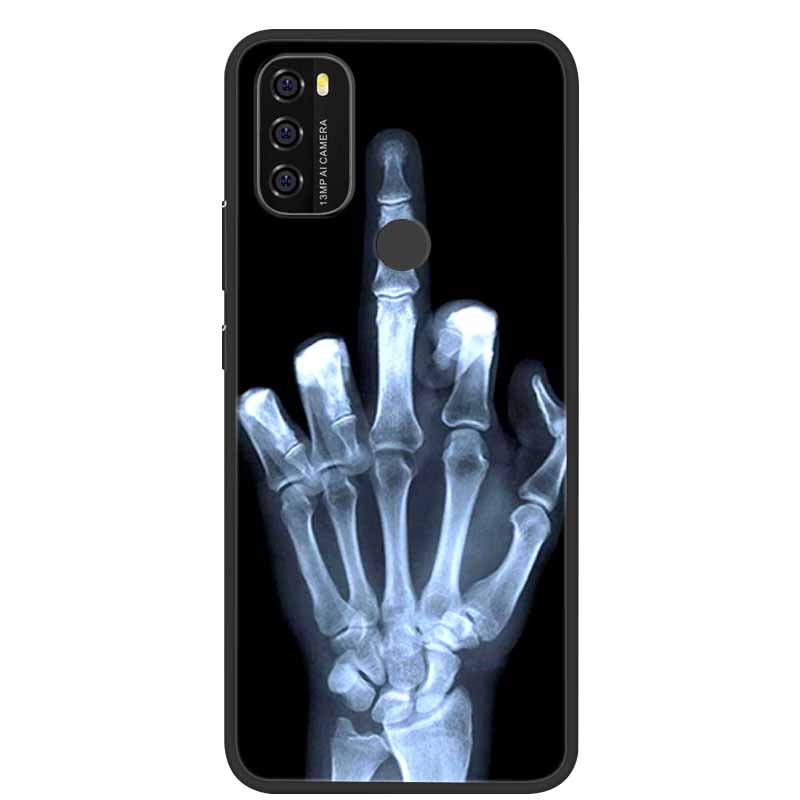 For Blackview A70 Case Cartoon Bumper Silicone TPU Soft Phone Back Cover For Blackview A90 A 90 Protective Cute Capa Cool Fundas