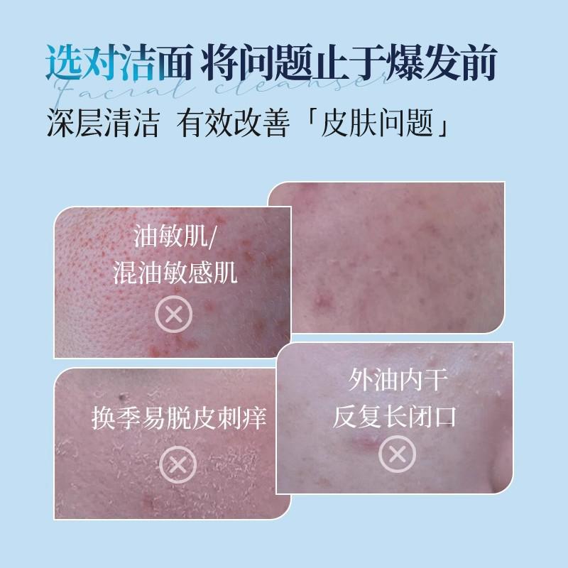 Amino Acid Protein Facial Cleanser with Oil Control