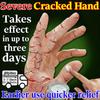 Long-Lasting Moisture Cream for Dry Cracked Hands Feet - Herbal & Safe