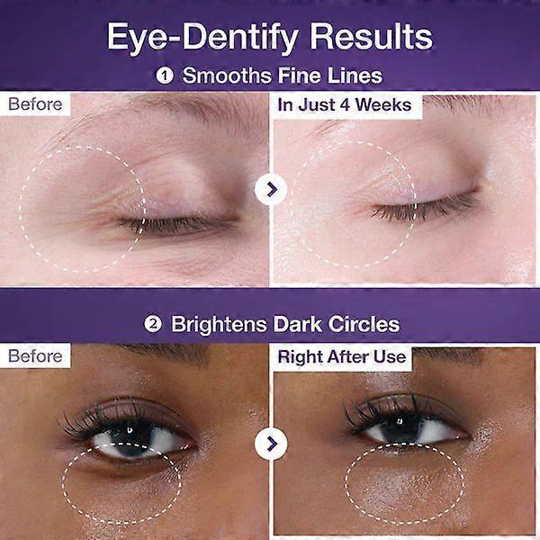 No. 9 NAD+ Retinol Anti-Ageing Eye Cream, Liquid Ultrasonic Eye Serum