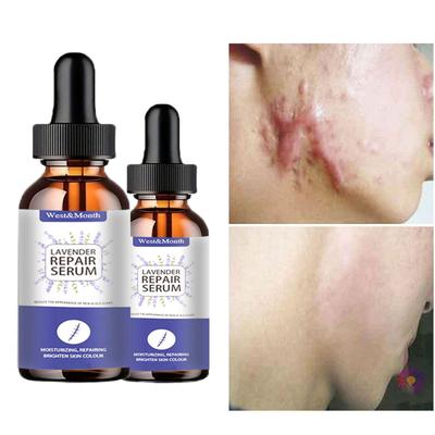 Lavendel reparierendes Serum, aufhellende Hautpflegeflüssigkeit, aufhellende Haut, nährende, feuchtigkeitsspendende Essenz