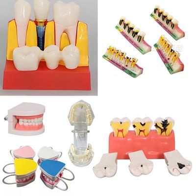 Dental Implant Teaching Model & Toothbrush Preparation Resin Mold
