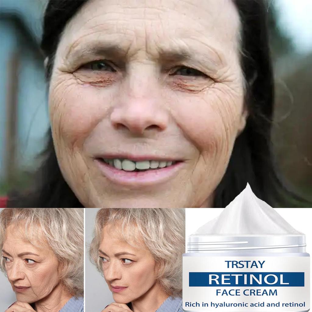 Hydratační krém proti stárnutí vrásek je jemný a nedráždivý, vyhlazuje vrásky, zesvětluje jemné linky a zanechává pokožku jemnou a zjemněnou.