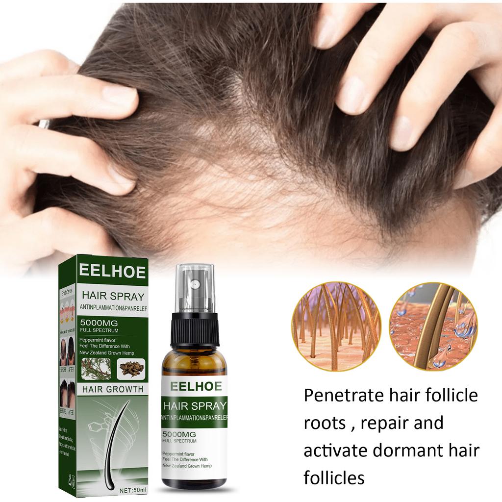 EELHOE Ingwer-Haarwachstumsspray, ätherische Öle, Haarausfall-Behandlung, schnelles Wachstum, verhindert trockenes, krauses, beschädigtes, dünner werdendes Haar, Reparaturpflege, 50 ml