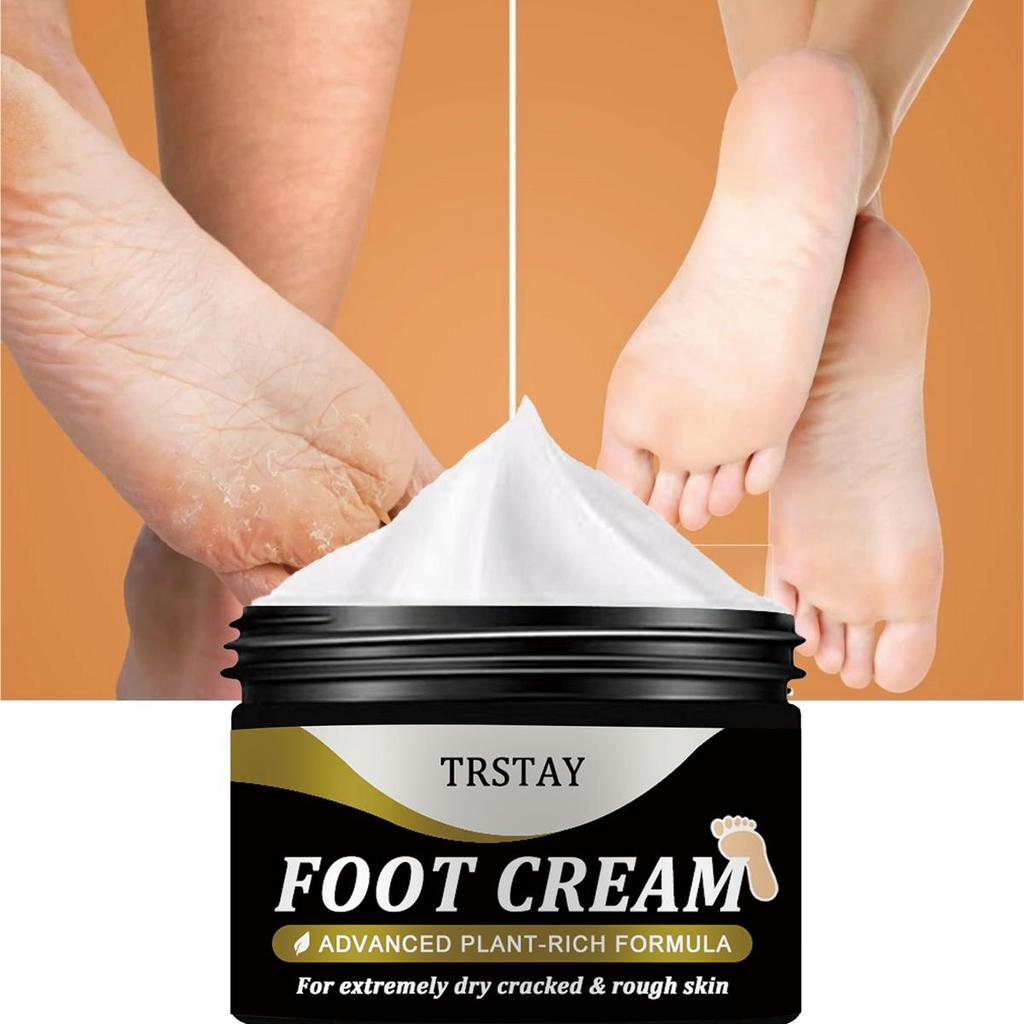 Foot Moisturizing Cream Is Rich In Plants and Can Be Used Flexibly for Dry, Cracked, and Rough Skin. Foot Moisturizing Cream