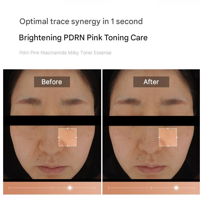 Medicube Toner Lacté Niacinamide Rose 250ml (3 Options)