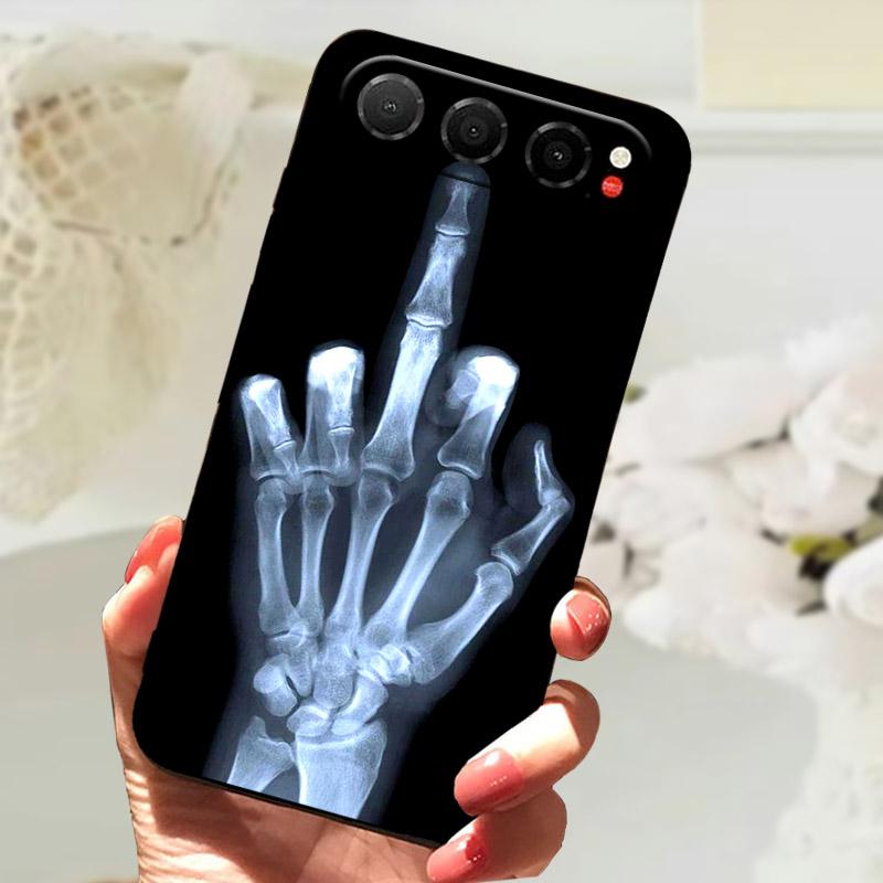Funda For ZTE Nubia Air Silicone Case NubiaAir 5G Phone Case Cover For Nubia Air Bumper Z2468N Soft TPU Protective Matte Shell