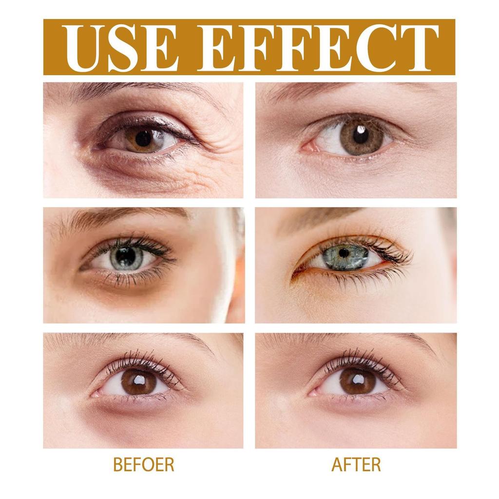 Lutein Anti-Falten-Öl-Augencreme Entsalzt feine Linien Befeuchtet Befeuchtet Massageball-Augencreme 20 ml