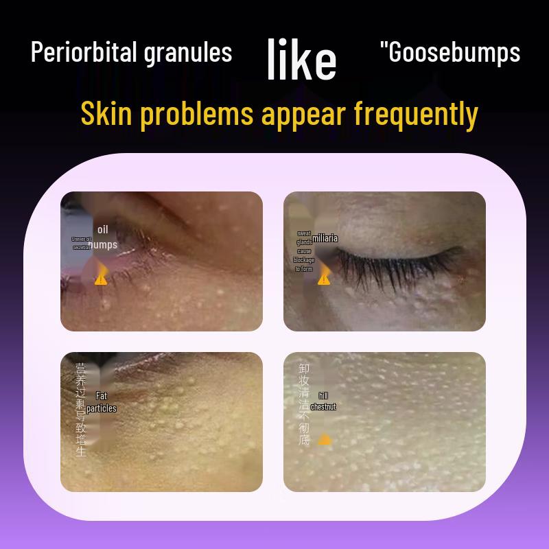 Layanana Eye Cream for Milia, Dark Circles & Fine Lines