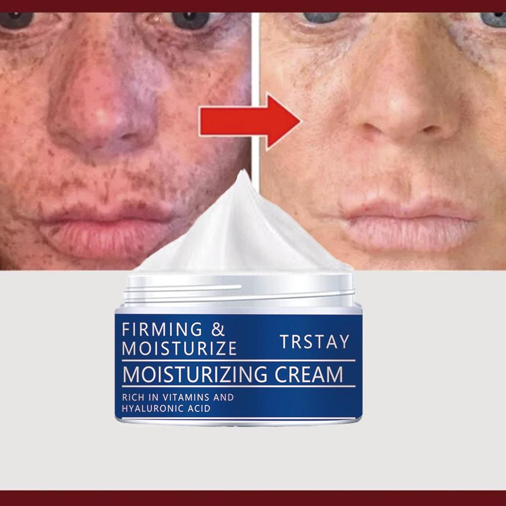 Retinolový krém vyhladzuje jemné linky a vyrovnáva tón pleti, zatiaľ čo retinol a kyselina hyalurónová pleť hydratujú a vyživujú, zanechávajú ju jemnú a jemnú.