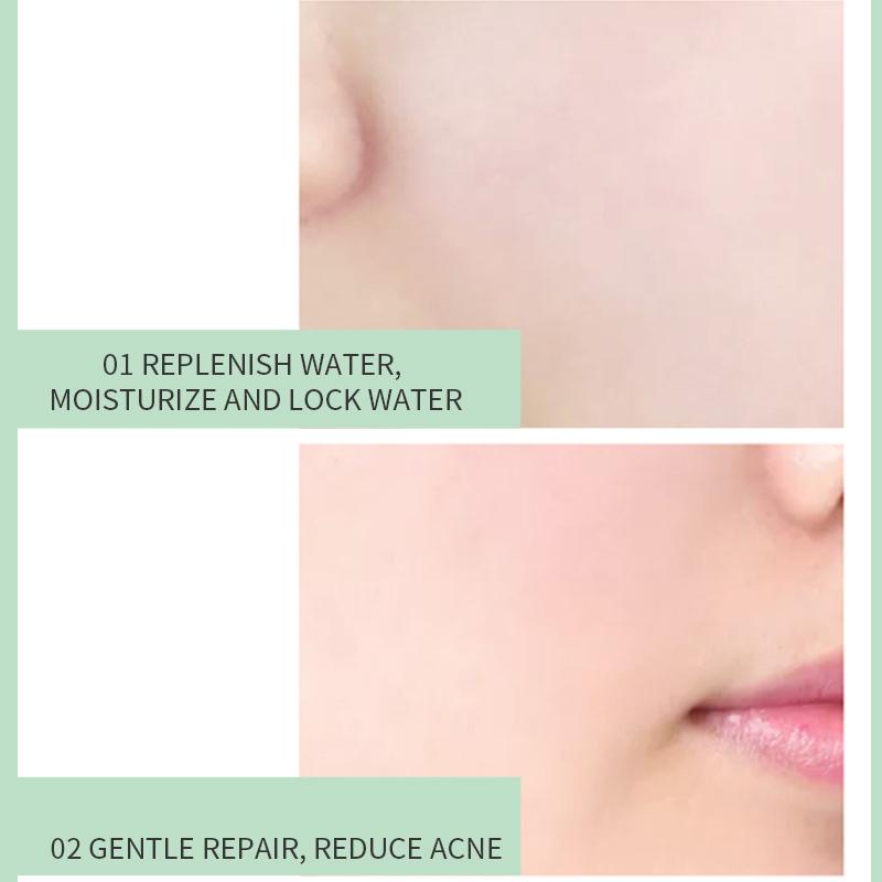 TJE Aloe Vera Gel 150g Feuchtigkeitsspendend, für zarte, zu Akne neigende und antiempfindliche Haut