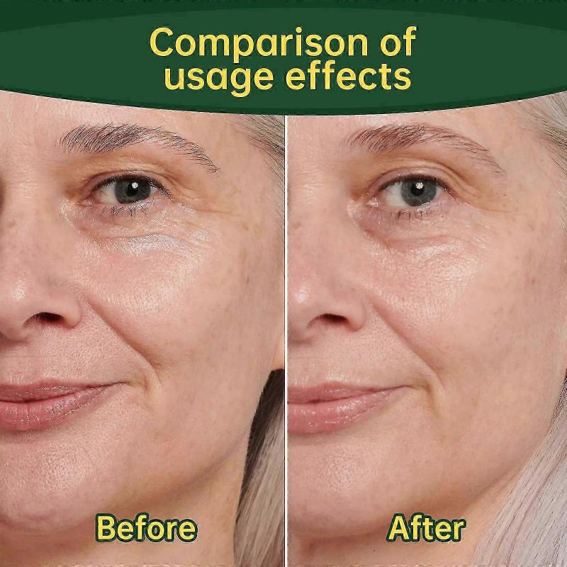 3x Stammzell-Kollagen-Peptid-Tropfen Anti-Aging Lifting Straffung schlaffe Haut Faltenreduzierung