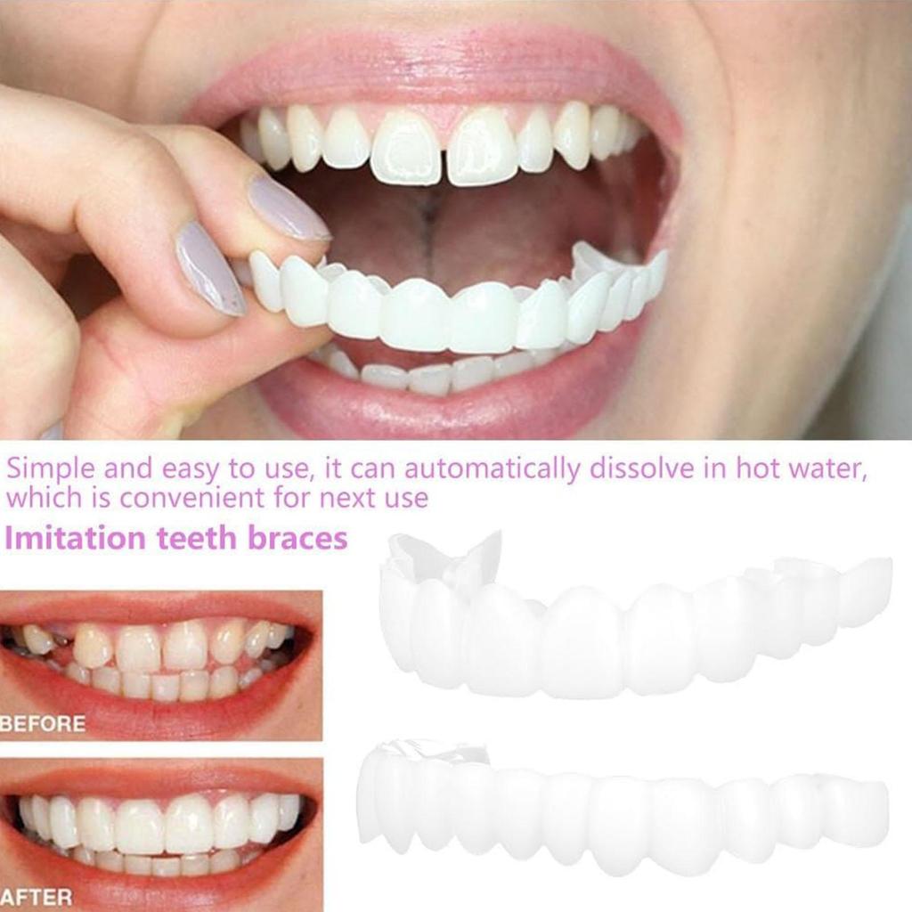 Silicone Denture Set Fit Temporary Orthodontic Teeth Dentures Fake Tooth Orals Hygiene Care Whitening Dentures Simulation Braces
