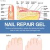 Nail Care Gel Hand Foot Onychomycosis Soft Nail Thickening Nail Luminescent Nail Repair Gel