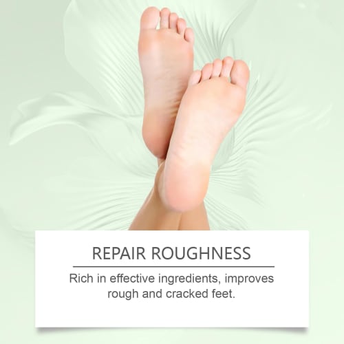 60% Urea Cream for Feet, Maximum Strength, for Dry, Cracked Feet and Hands, Softens, Deeply Moisturizes, and Relieves Cracked and Dry Skin (2 Pieces)