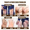 15g Cracked Heel Treatment Cream Repairing Feet Anti-Dry Cracked Peeling Chapped Moisturizing Foot Cream