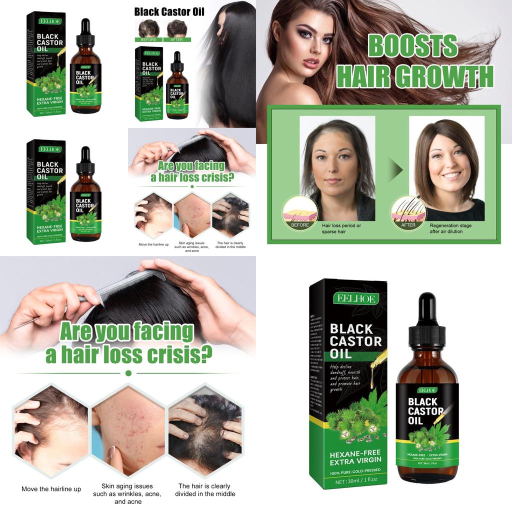 Eelhoe Castor Oil Hair Growth Serum Nourishing And Strengthening 30ml For Thicker Hair