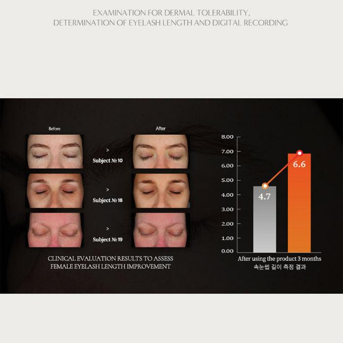 ROOTON Alpha Erguen Wimpernserum 5 ml