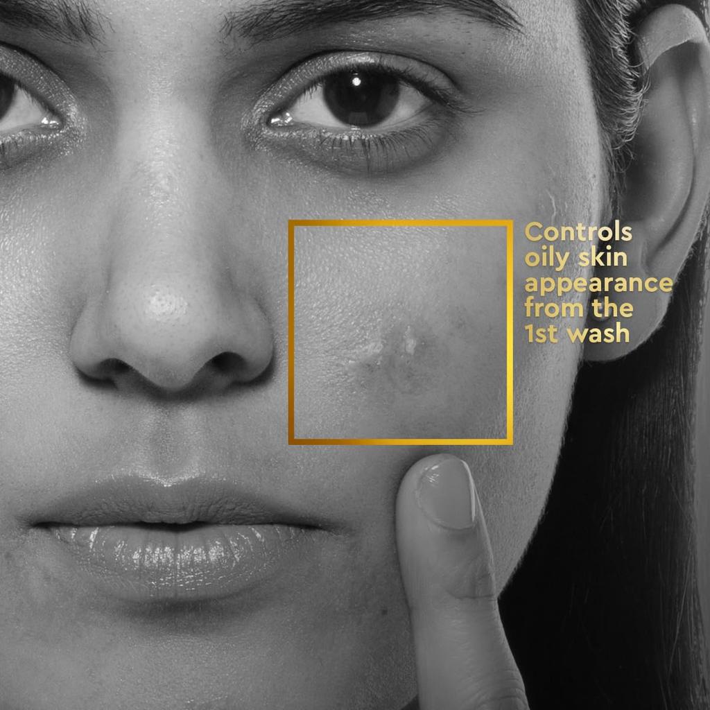 VLCC Clinic Anti Acne Face Wash 150 Ml For Acne Prone Skin With Salicylic Acid And Neem For Oil Control And Clearer Skin