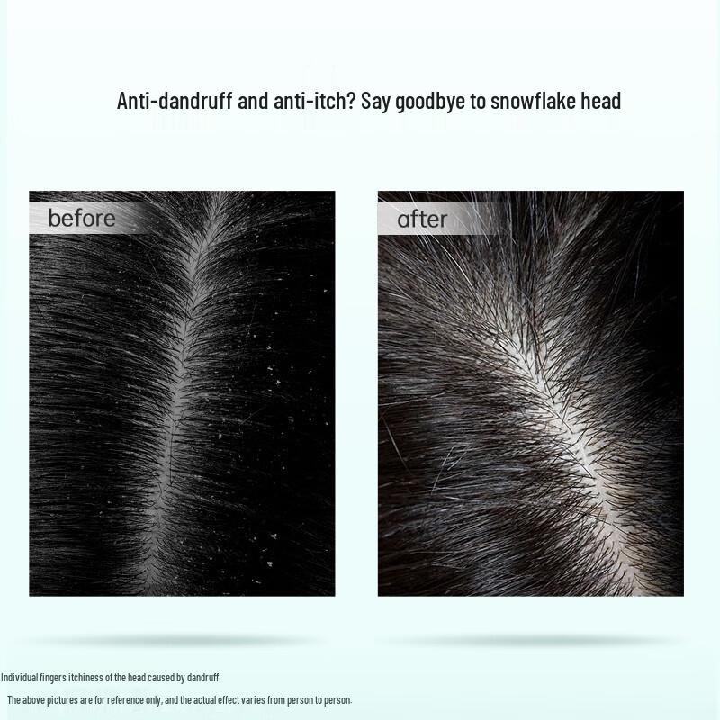 Ziyuan Tea Seed Oil Control Anti-Dandruff Shampoo