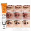 Krem pod oczy z witaminą C Przeciw cieniom i workom pod oczami Przeciw obrzękom Przeciw zmarszczkom Anti Aging Nawilżające serum do pielęgnacji skóry oczu 20ml