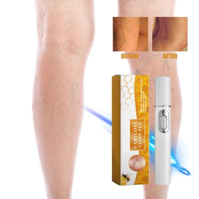 La penna massaggiante per la cura delle vene allevia efficacemente i sintomi della rete vascolare, allevia il disagio alle gambe e migliora l'affaticamento delle gambe