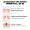 Blackhead Remover Hydrocolloid Nose Strips Deep Cleansing Facial Pore Patch for Nighttime Skincare 10pcs
