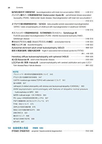 Easy-to-understand Brain MRI, Revised 4th Edition (Image Diagnosis Special Edition KEY BOOK Series)