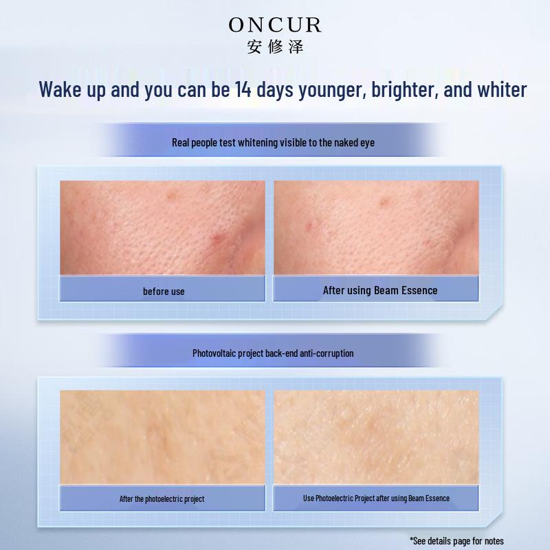 Anxiuze Whitening Light Beam Essence