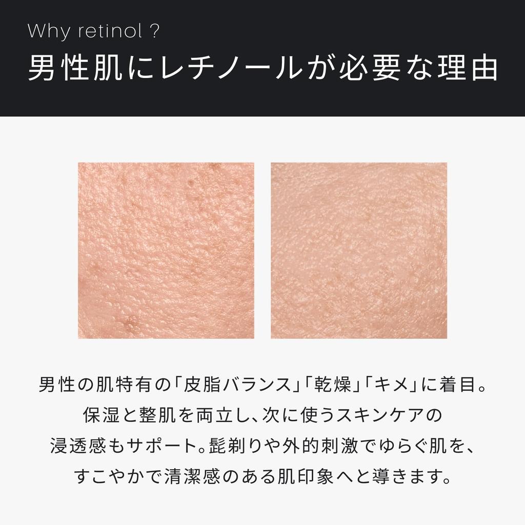 ATIDIMU Lotion Highly Moisturizing and Refreshing Formula Contains Retinol Derivatives Suitable for Sensitive and Oily Skin Made In 150mL Men's