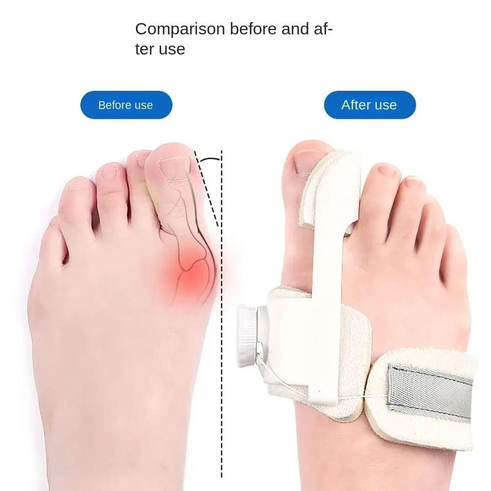 Rotatable Big Toe Straightener Adjustable Bunion Splint Valgus Bunion Valgus Corrector  Men/Women