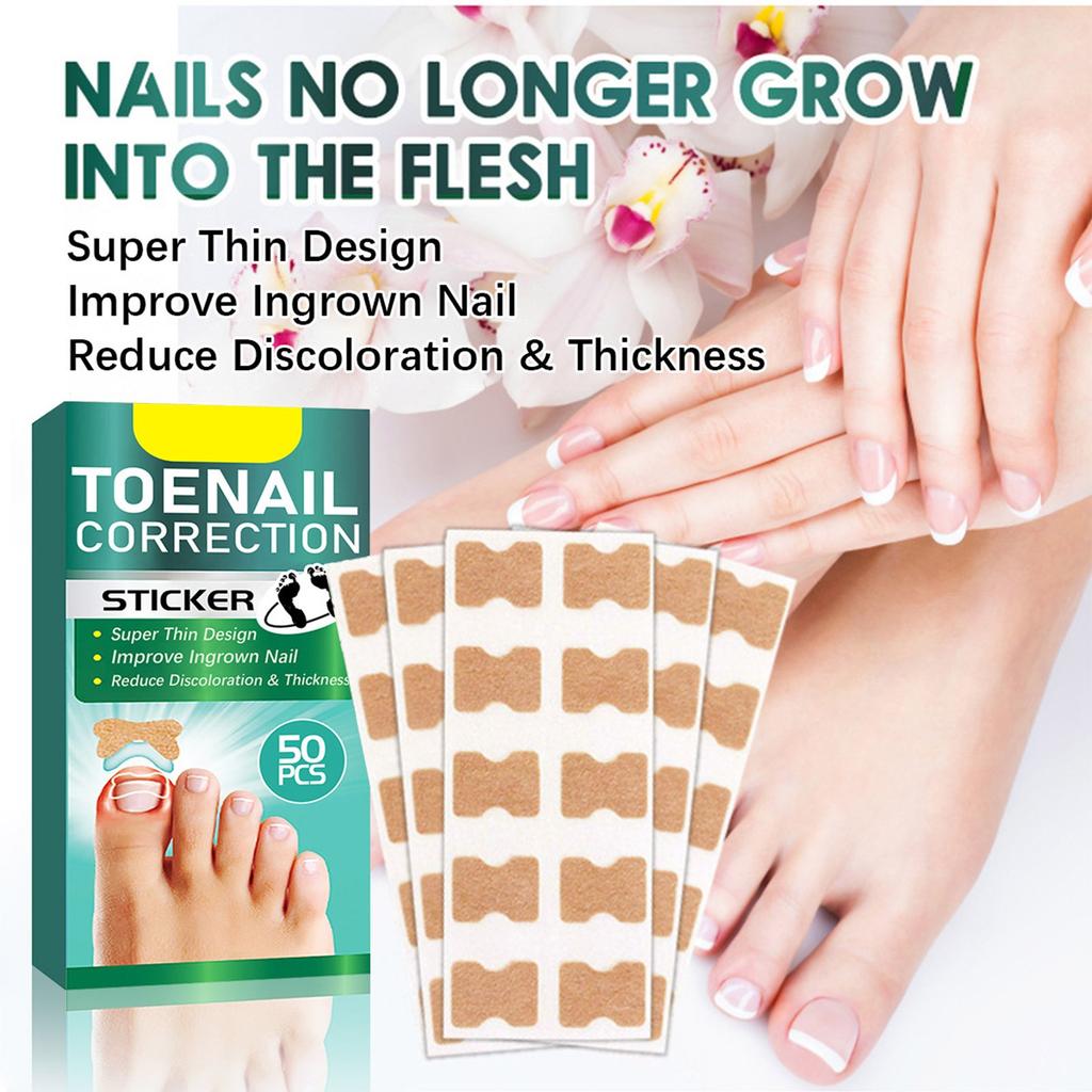 Aufkleber zur Korrektur eingewachsener Zehennägel für Hände und Füße, weicher Nagel, eingelegte Nagelverdickung, helle Nagelfurche, graues Nagelpflegepflaster, 50 Stück