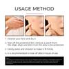 Acne Pimple Patch Repair Facial Acne Acne Cover Acne Smooth Skin Care Pimple Patch Mild Non-Irritating Skin