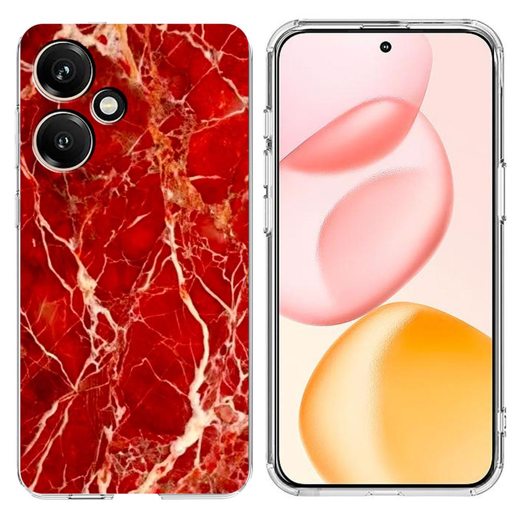 For Honor 400 5G (Global) Case Marble Pattern Printing Soft TPU Phone Cover
