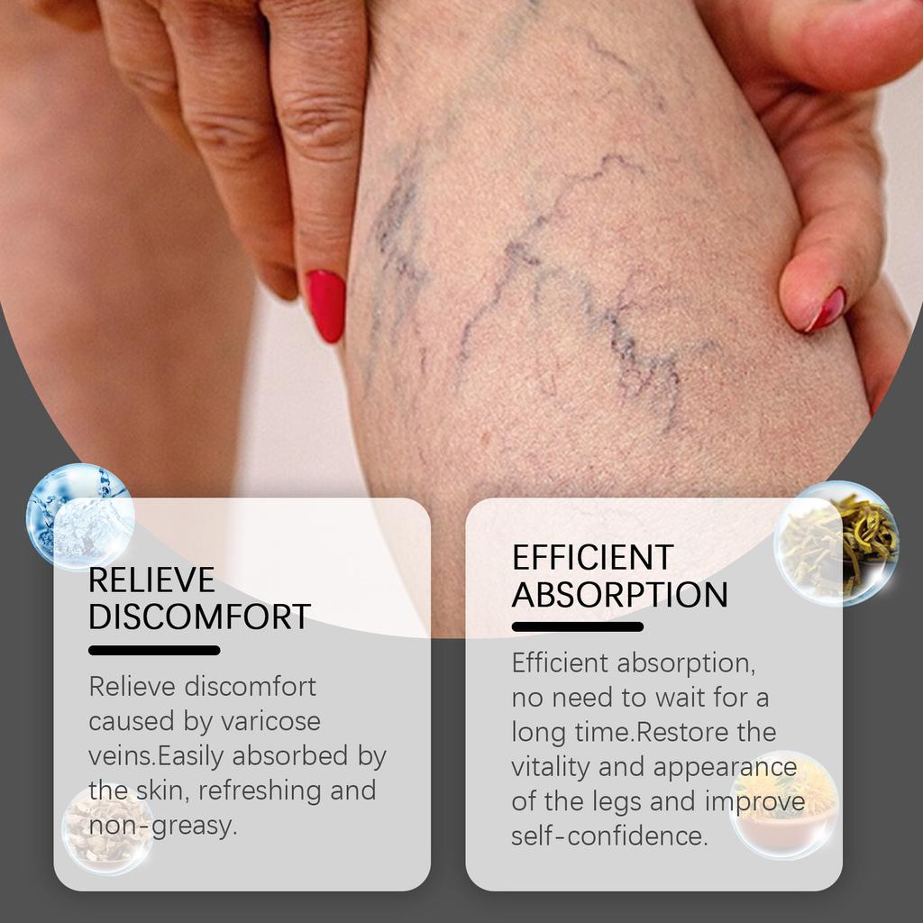Varicose Veins Relief Cream Cramps Vasculitis Phlebitis Legs Shape Bulges Pain Angiitis Removal Soreness Spider Veins Ointment