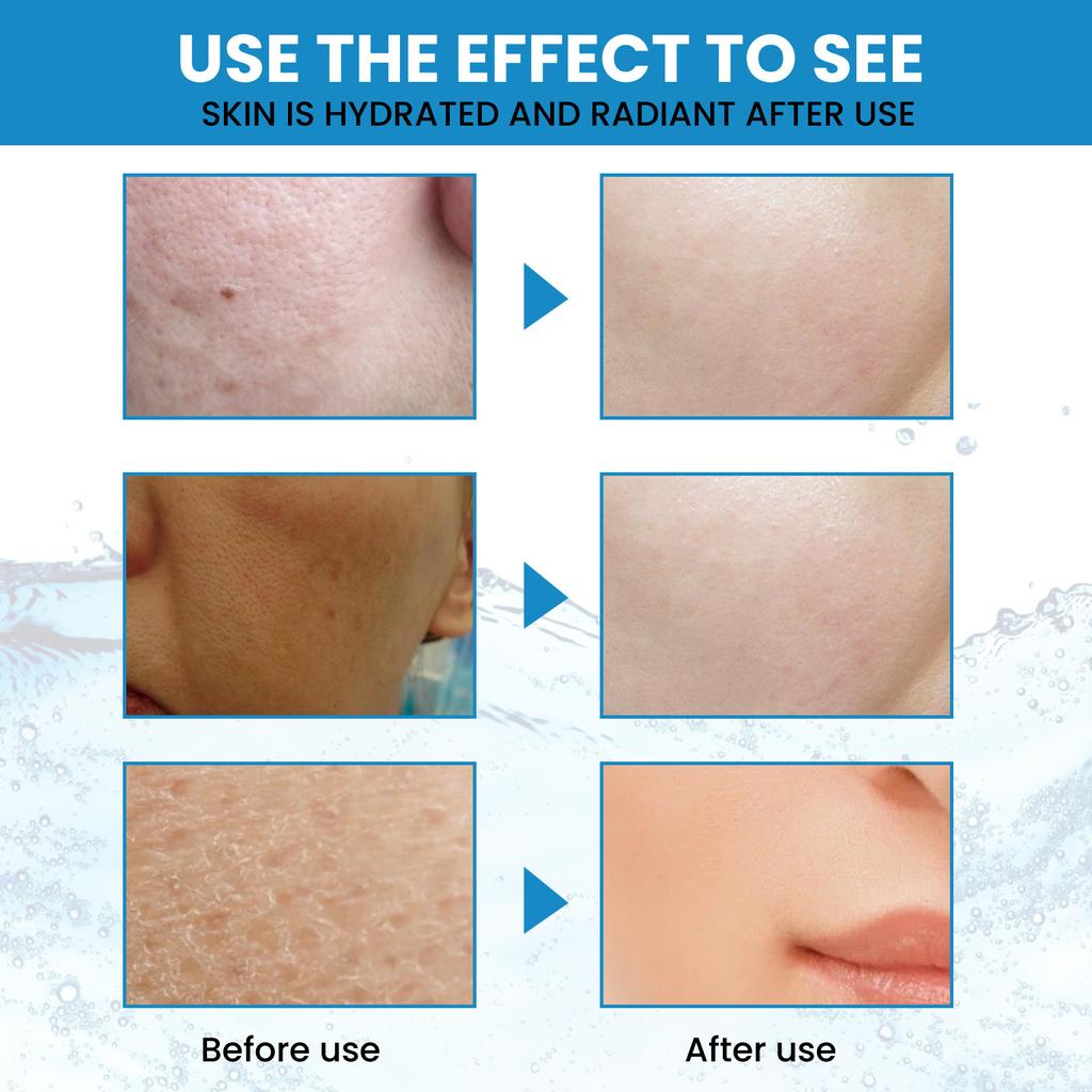 EELHOE Hyaluronic Acid Moisturizing Serum Shrink Pores Oil Control Face Essence Whitening Brighten Wrinkle Remover Firming Products