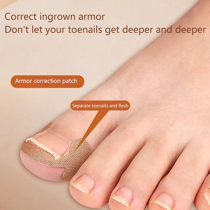 100 Buc. Plasture pentru Ciuperca Unghiei de la Picior Plasture Adeziv pentru Repararea Unghiilor Autocolant pentru Corecția Unghiilor Încarnate Îngrijirea Unghiilor de la Picior Paronichie Plasture pentru Unghii