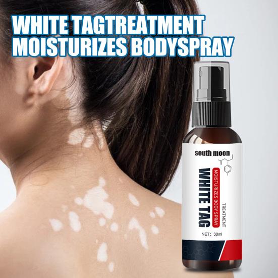 30ml White Tag Liquid Unique Easy to Use Plants Extracts White Tag Treatment Body Spray for Ladies