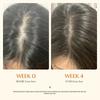 Scalp Care Hair Serum Nourishing Repair Hair Thickening Anti Hair Loss Treatment 2-Pack Portable