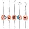 Dental Teeth Whitening Kit Dentist Tooth Plaque Calculus Tartar Remover Tool Set
