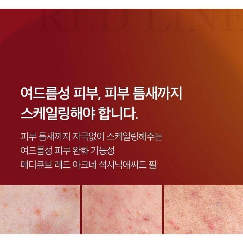 medicube - Red Acne Succinic Acid Peel