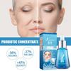 Probiotic Serum Gently Nourishes Facial Skin Moisturizing Skin Care Essence