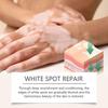 2025 Latest Model  Body Care Cream, Relieve Itching And Swelling Of Hands And