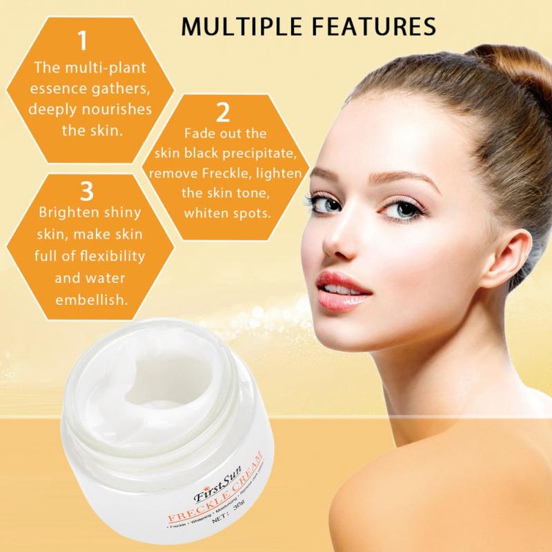 melasma cream for face