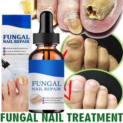 Repair Nail Fungus Treatments Essence Foot Care Serum Toe Nails Fungal Removal Gel Anti-Infection