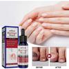 Effective Nail Repair  Moisturizing Solution for Healthy, FungusFree Nails