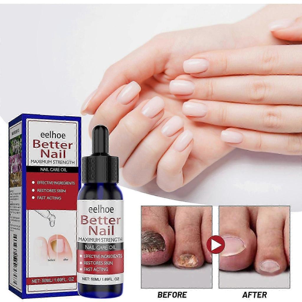Effective Nail Repair  Moisturizing Solution for Healthy, FungusFree Nails