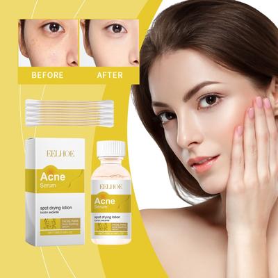Face Essence Care Acne Muscle Acne Closing Gentle Cleansing Face Skin Face Essence